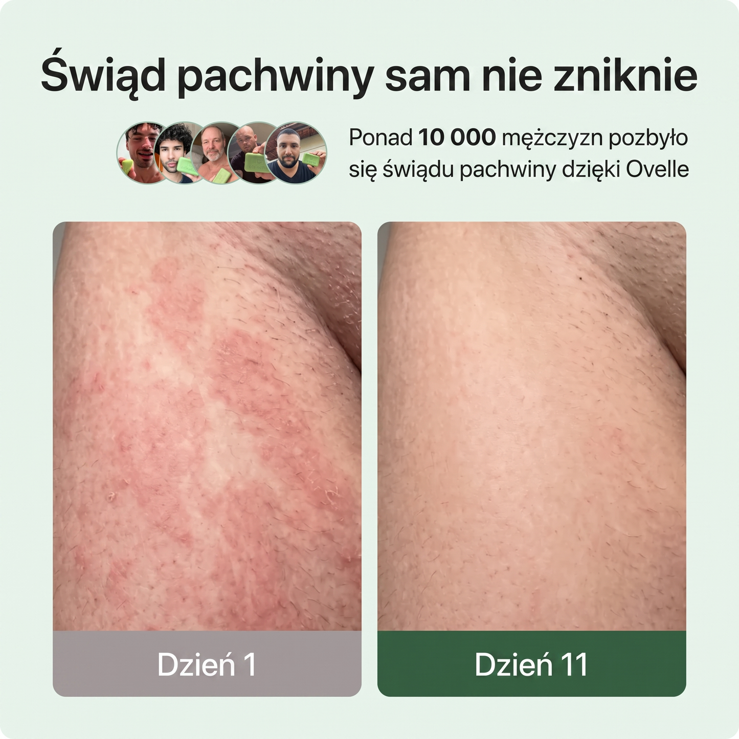 Ovelle Mydło Przeciwgrzybicze