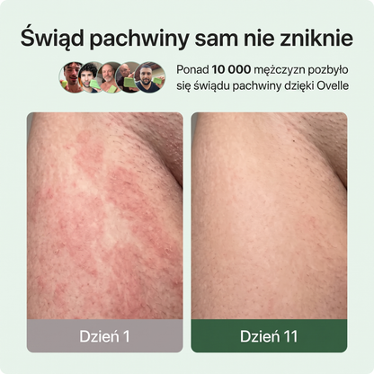 Ovelle Mydło Przeciwgrzybicze