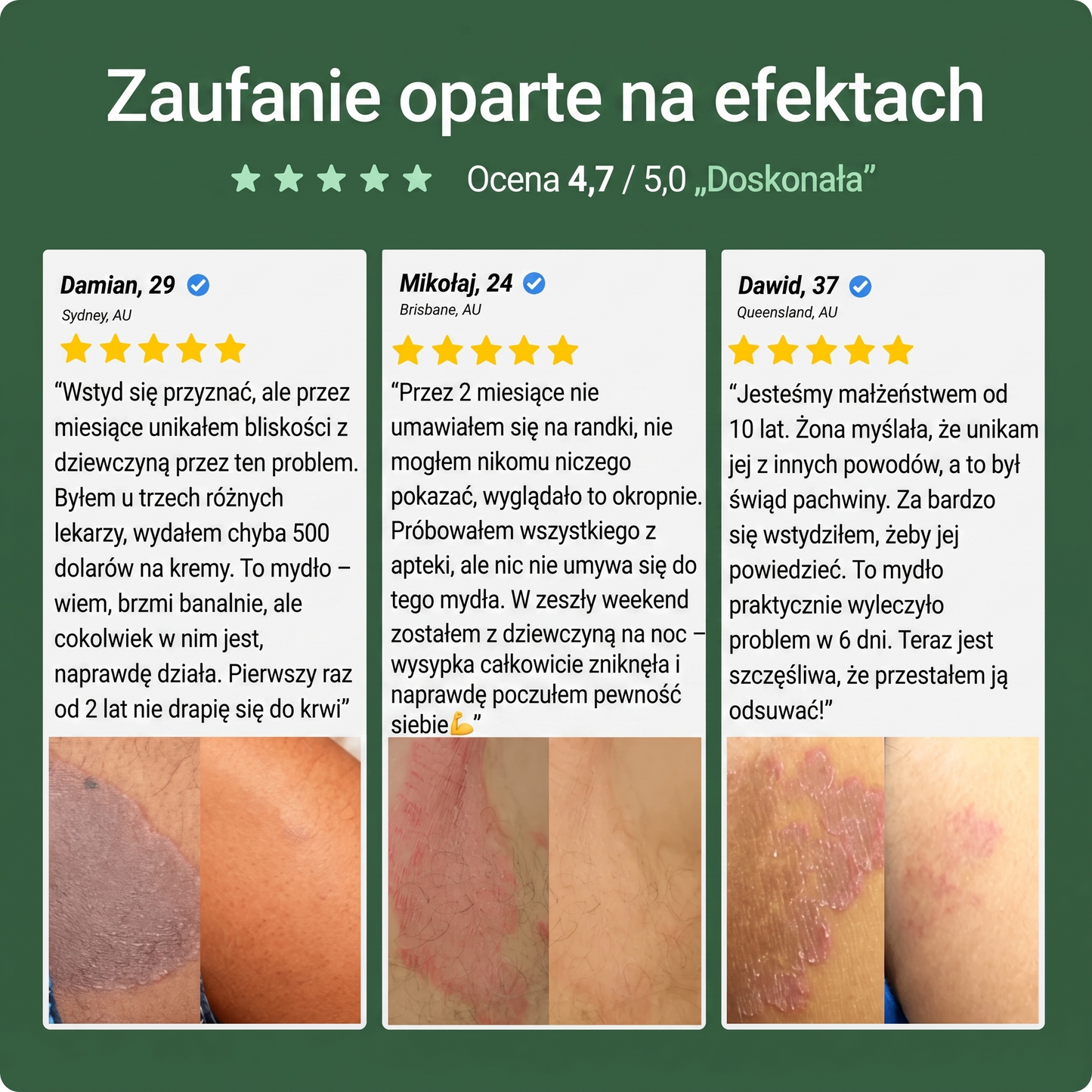 Ovelle Mydło Przeciwgrzybicze